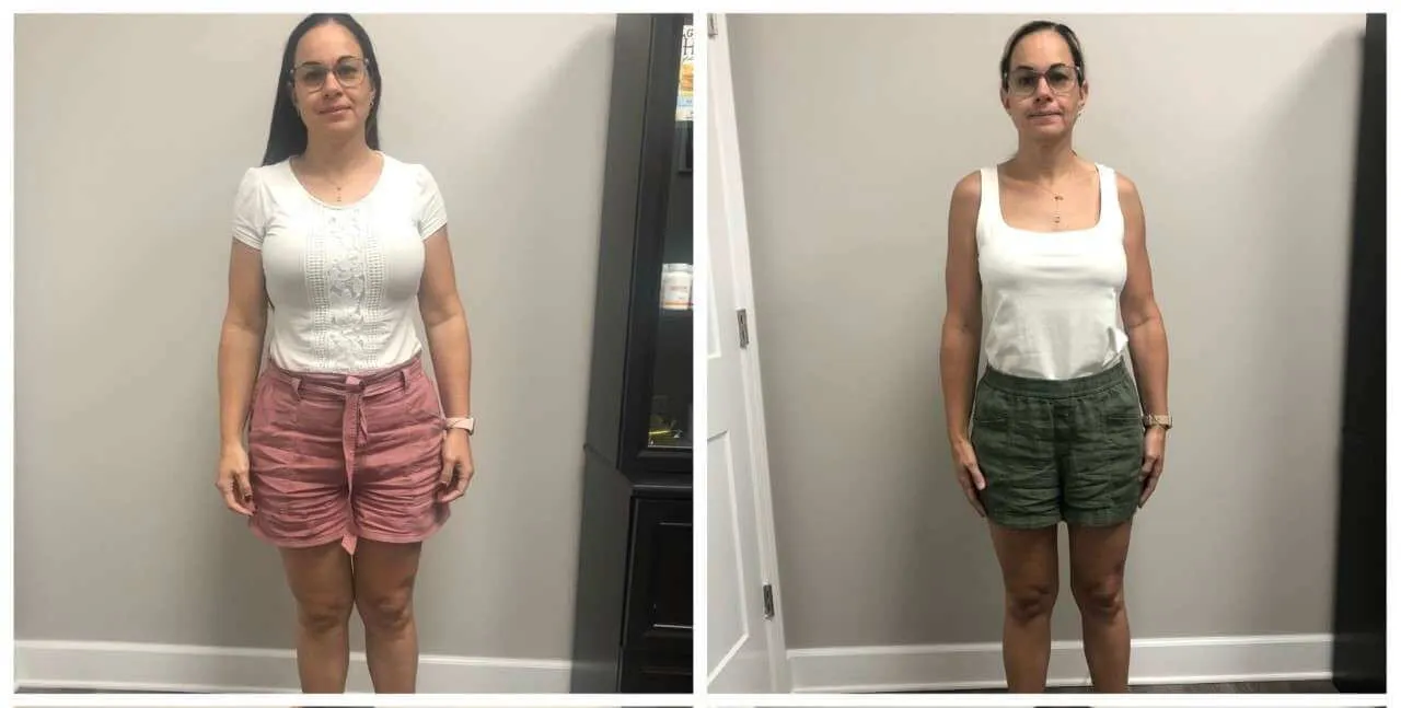 Body Contouring Testimonial 1