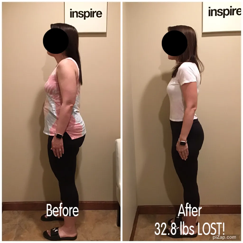 Body Contouring Testimonials 3