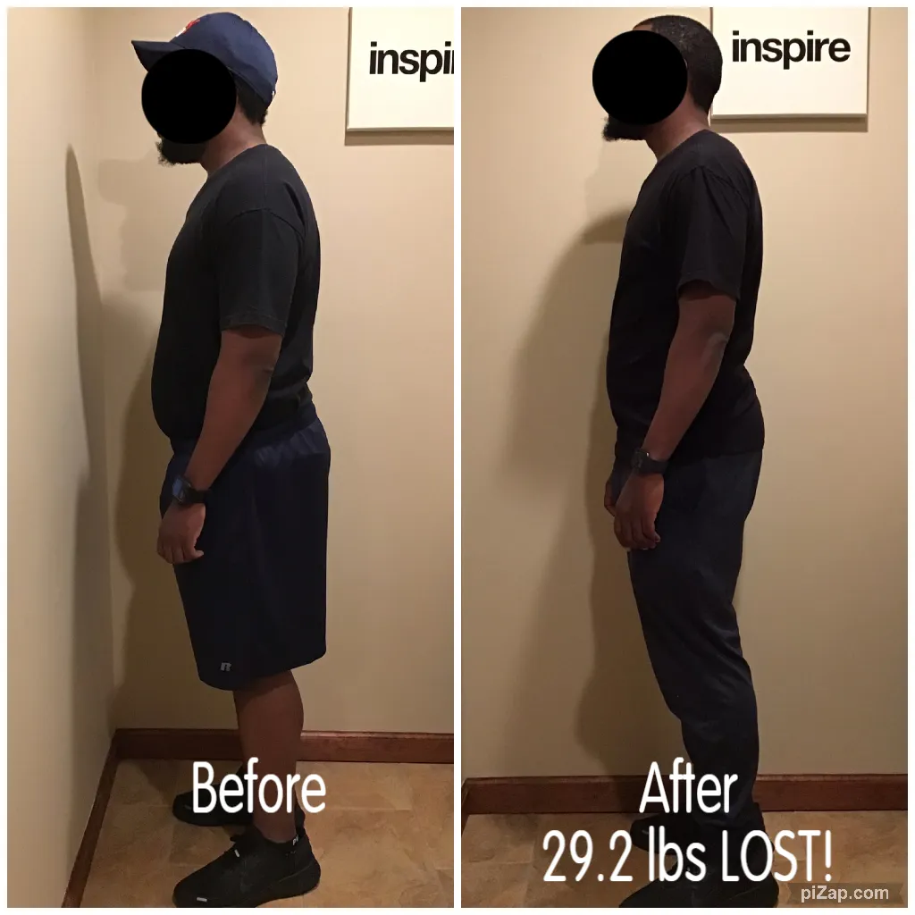 Body Contouring Testimonials 4